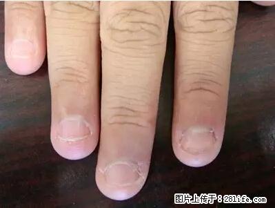 剪指甲、挖耳屎，这些日常小动作竟隐藏大危害！ - 巢湖生活资讯 - 巢湖28生活网 ch.28life.net
